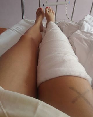 nooo... ostatnio dumnie wrzuciłam zdjęcie z moją husqvarną... i to by było na tyle 😉 jakby to powiedzieć... ona nie wybacza błędów... 😉

za to teraz będę miała dużo czasu na wspomnienia... bo aż 3 miesiące...
także może czas uzupełnić galerię...? #husqvarna450 #sporttozdrowie #gips #endurolive #nevergiveup #bestrong 😉